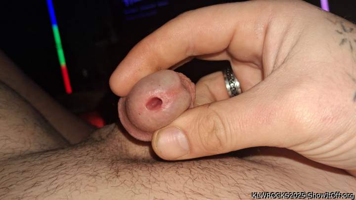 My peer.hole