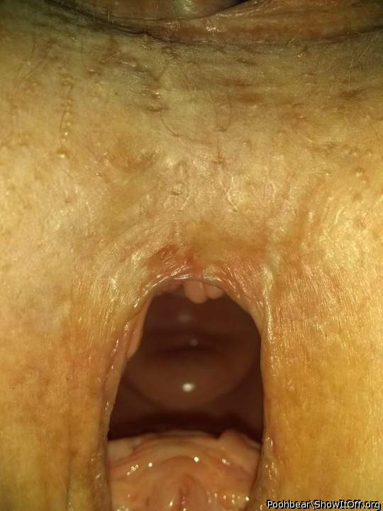I would open that up.......oh god...