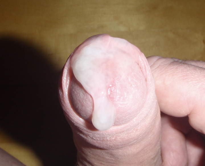 OMG! Look at that lovely sperm!  