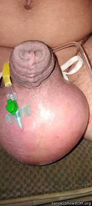 Penis pump