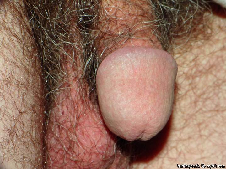 Adult image from turkeyneck