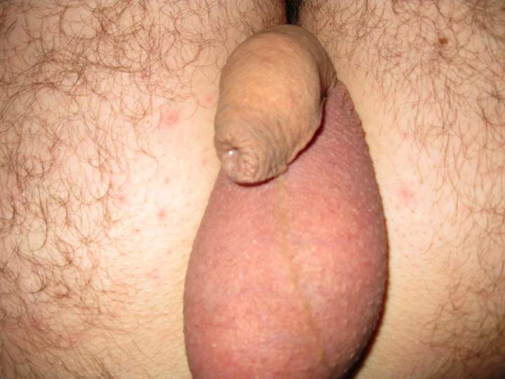 Adult image from Win_Gerhard