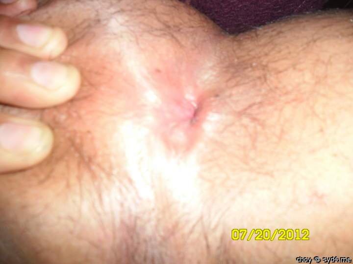 Adult image from choy