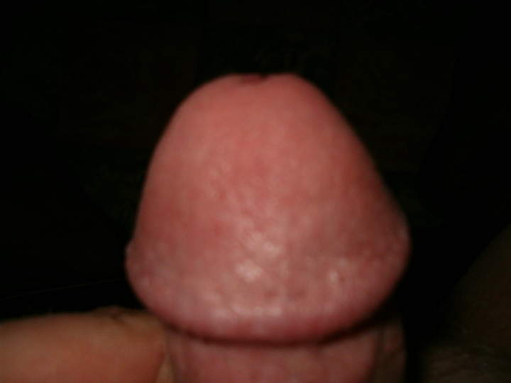 Adult image from fronve
