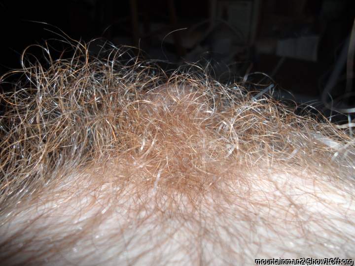 Pubes