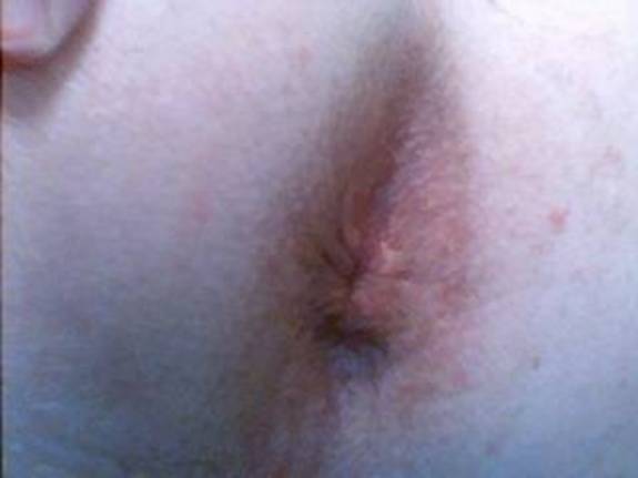 Adult image from countlodoss