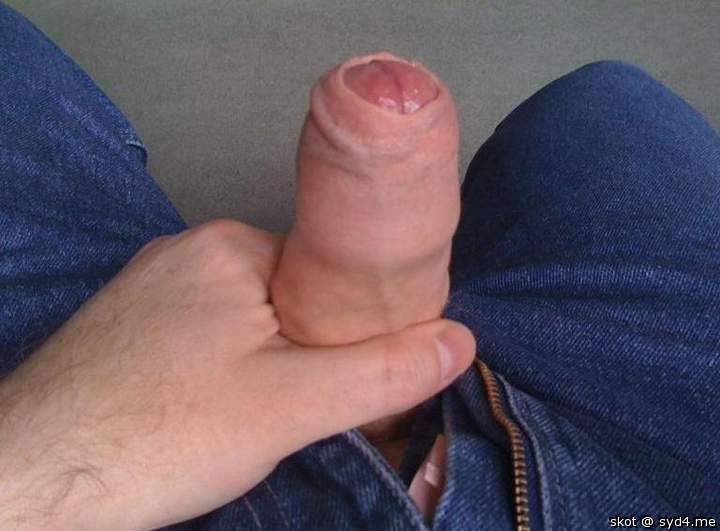 Skin up
