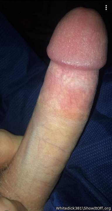 Adult image from Whitedick381
