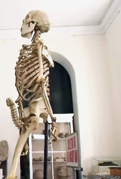 My recent xray