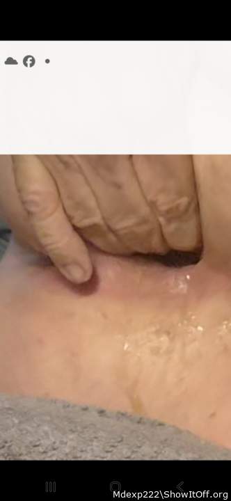Stretching my hole!