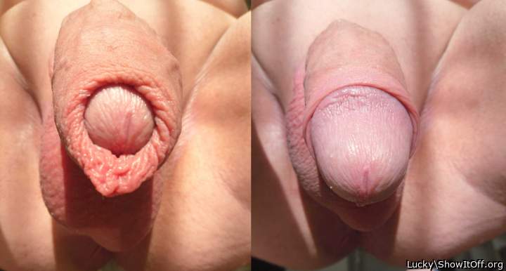 comparison