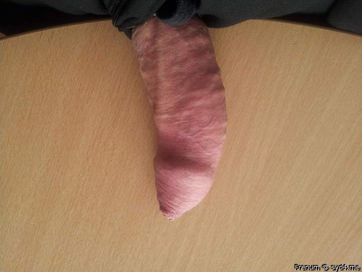 Adult image from Frenum
