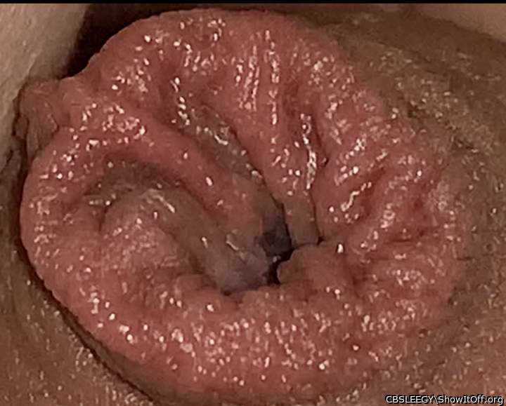 Foreskin Flower Detail