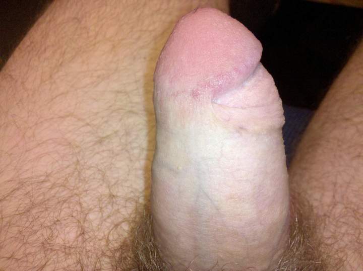 Adult image from skinb