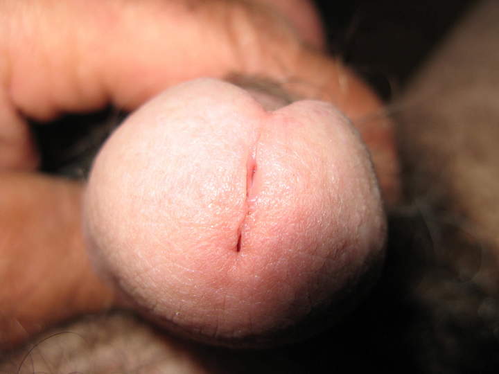 Adult image from turkeyneck