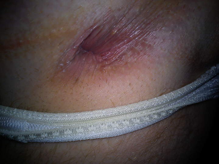 Adult image from mack101