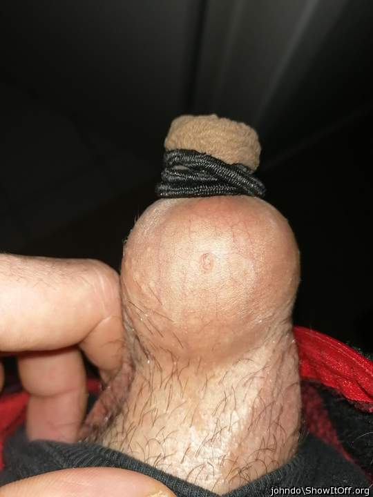 Do you have extend your foreskin ?