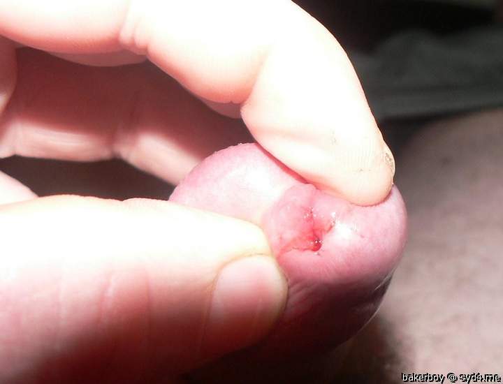 Adult image from bakerboy