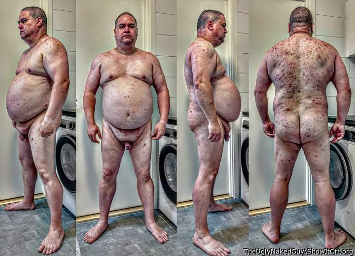 My body