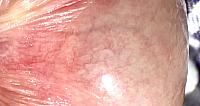 Vein structure in the helmet!